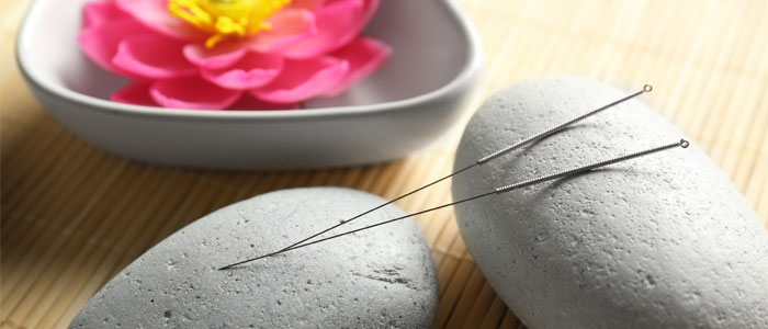 acupuncture needles placed on two stones